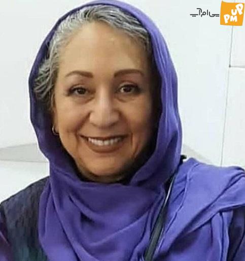 عکسی از مریم سعادت بازیگر سرشناس سینمای ایران که او را از فیلم زیزی گولو بیشتر می شناسید با صورت شکسته به تازگی منتشر شده است.