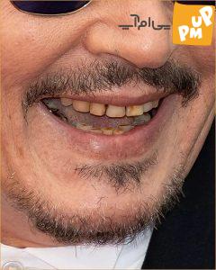 دندان های خراب و افتضاح “جانی دپ” سوژه عکاسان شد/ عکس