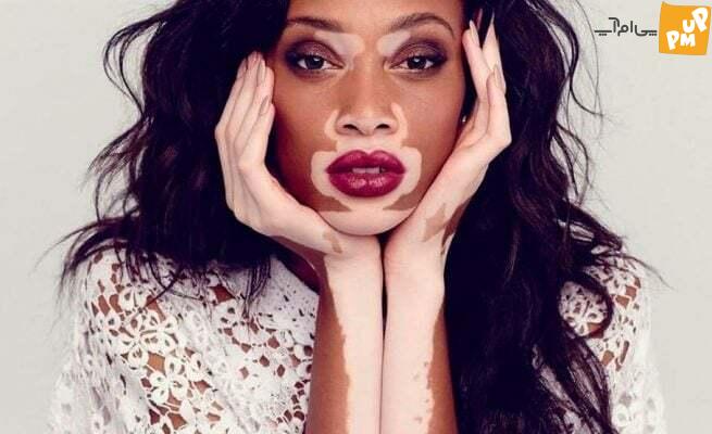 عجیب ترین مدل های دنیا که با دیدن عکس هایشان شگفت زده خواهید شد! عجیب ترین مدل های دنیا که با دیدن عکس هایشان شگفت زده خواهید شد!