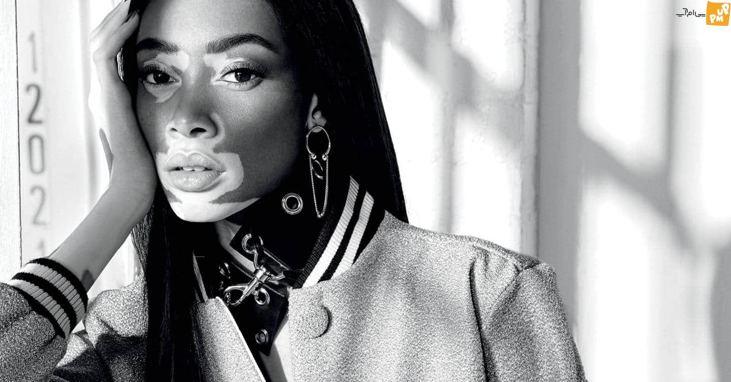 عجیب ترین مدل های دنیا که با دیدن عکس هایشان شگفت زده خواهید شد! عجیب ترین مدل های دنیا که با دیدن عکس هایشان شگفت زده خواهید شد!