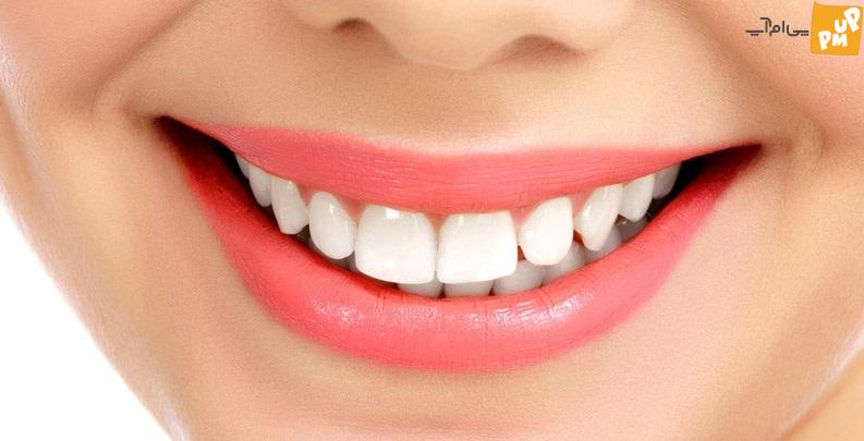 چگونه با روش های خانگی به طور طبیعی لب های قرمز داشته باشیم چگونه با روش های خانگی به طور طبیعی لب های قرمز داشته باشیم