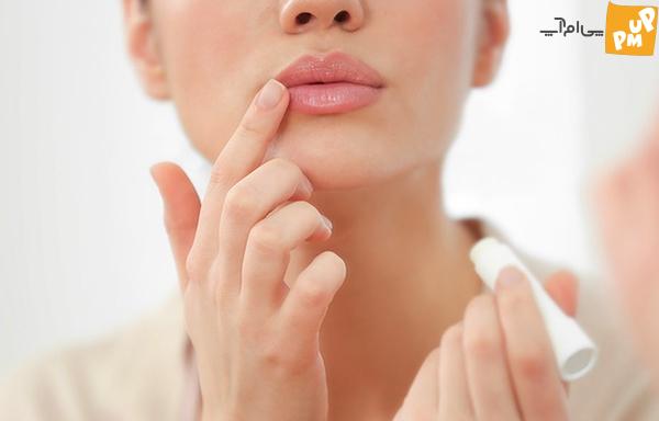 چگونه با روش های خانگی به طور طبیعی لب های قرمز داشته باشیم چگونه با روش های خانگی به طور طبیعی لب های قرمز داشته باشیم