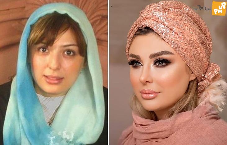 جراحی پلاستیک جراحی پلاستیک