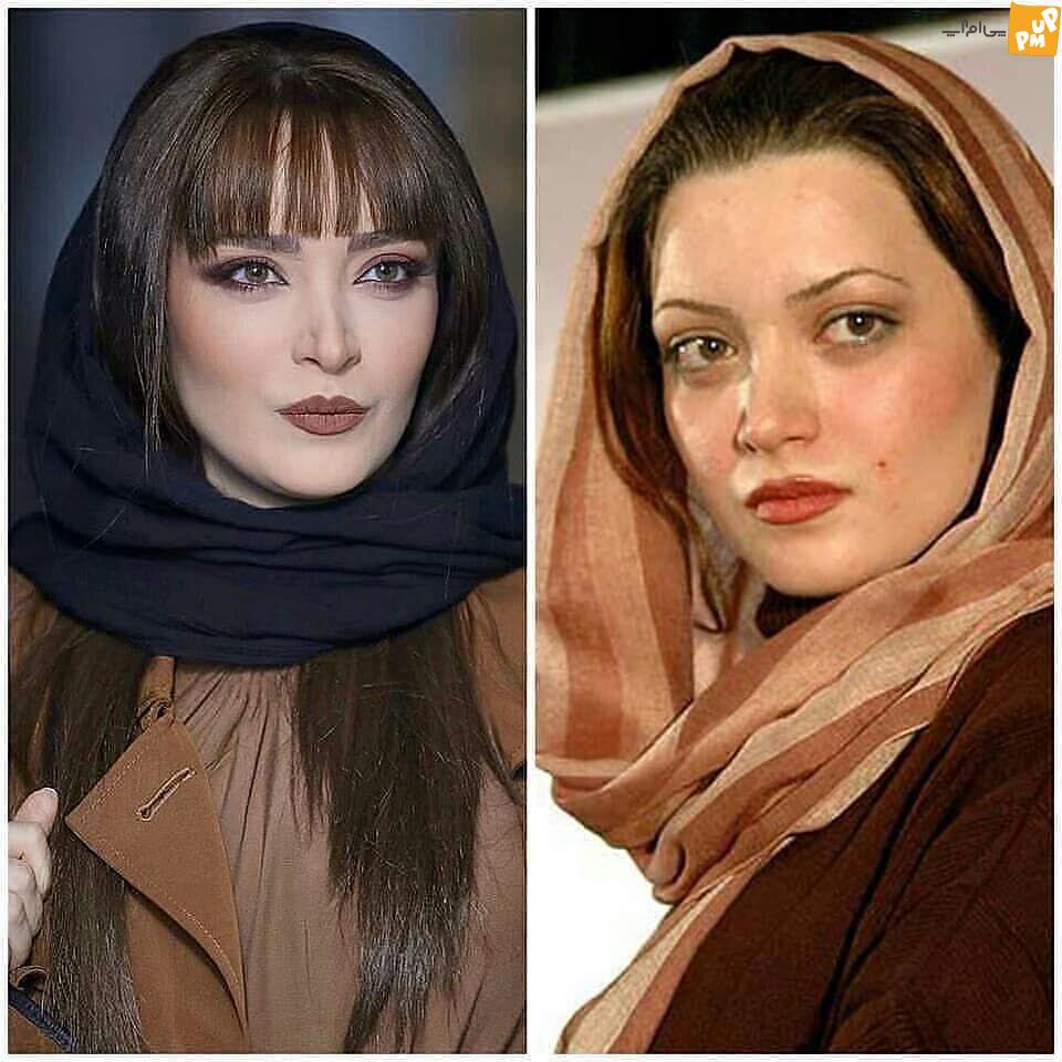 جراحی پلاستیک جراحی پلاستیک