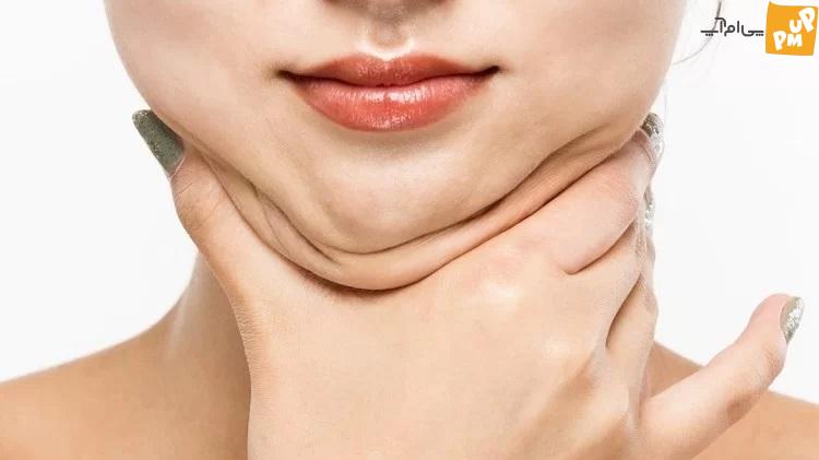 ترفندهای طلایی برای از بین بردن جای جوش بدون هزینه ترفندهای طلایی برای از بین بردن جای جوش بدون هزینه