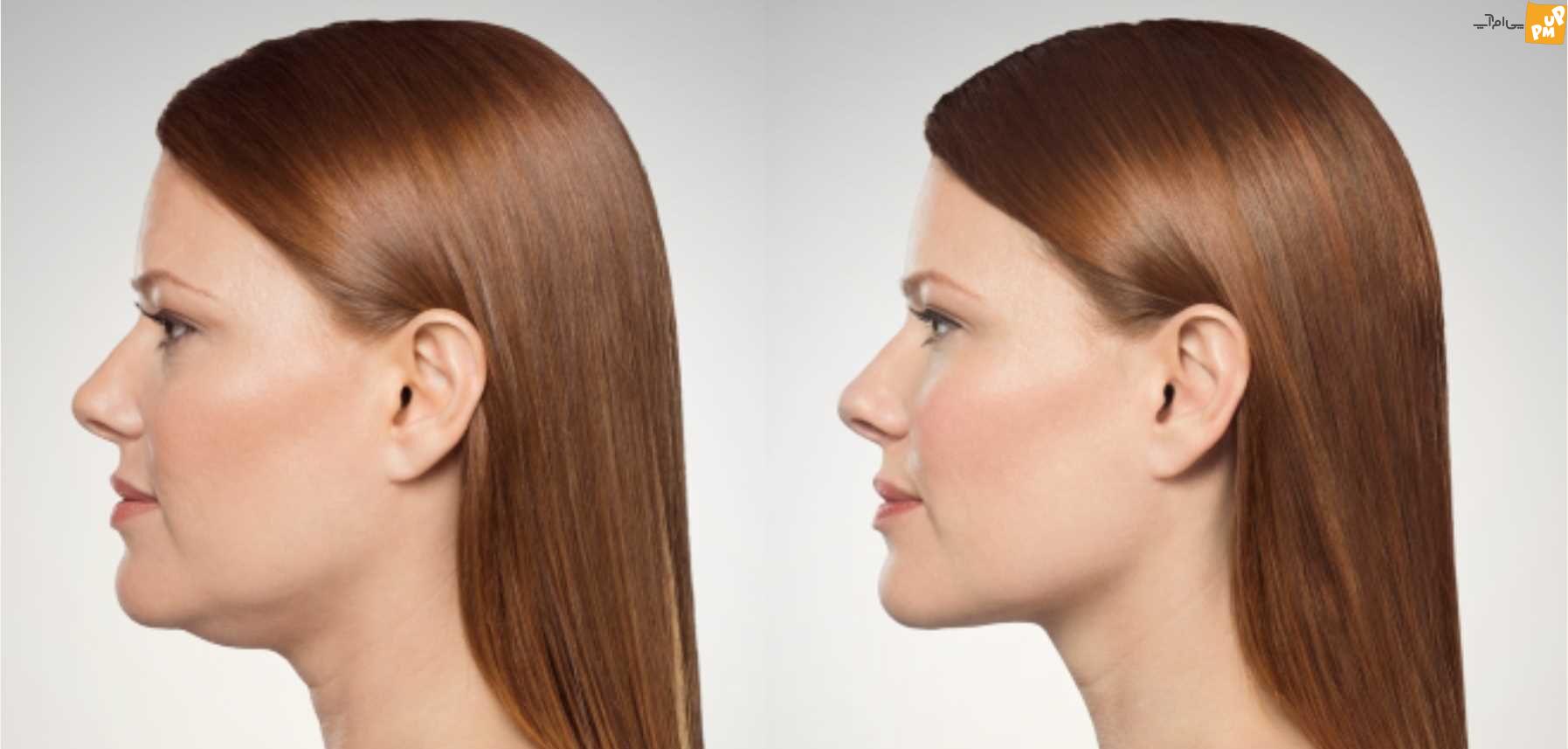 ترفندهای طلایی برای از بین بردن جای جوش بدون هزینه ترفندهای طلایی برای از بین بردن جای جوش بدون هزینه