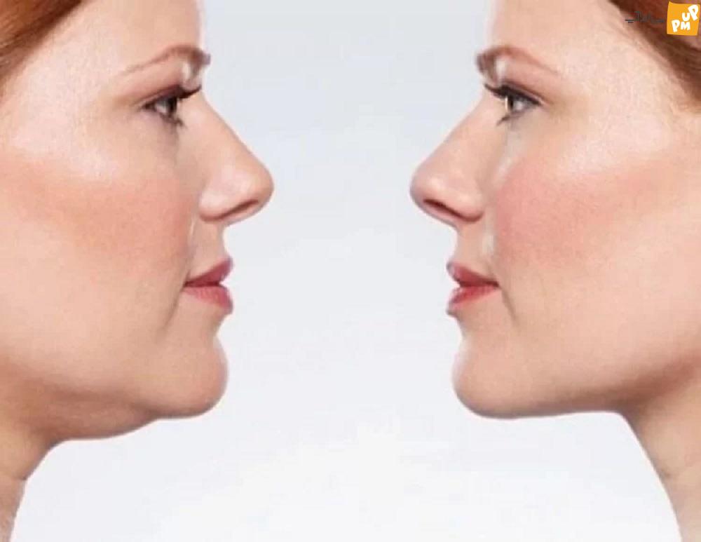 ترفندهای طلایی برای از بین بردن جای جوش بدون هزینه ترفندهای طلایی برای از بین بردن جای جوش بدون هزینه