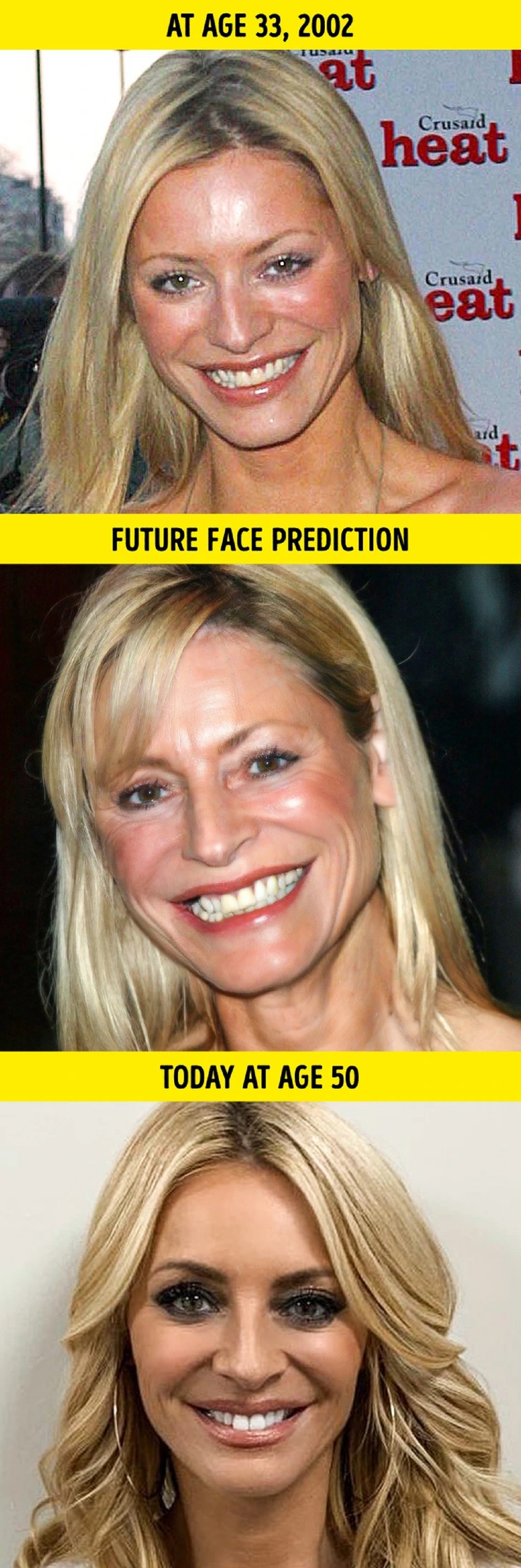 چهره ده زن مشهور قبل از جراحی زیبایی لو رفت چهره ده زن مشهور قبل از جراحی زیبایی لو رفت