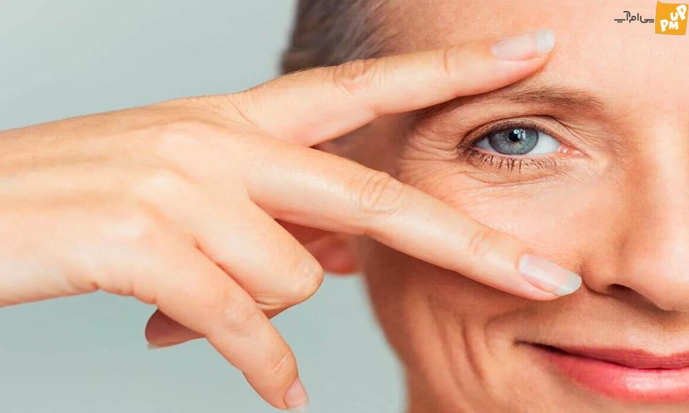 با چین و چروک دور چشم خداحافظی کنید / راه های درمان چین و چروک دور چشم بدون بوتاکس با چین و چروک دور چشم خداحافظی کنید / راه های درمان چین و چروک دور چشم بدون بوتاکس