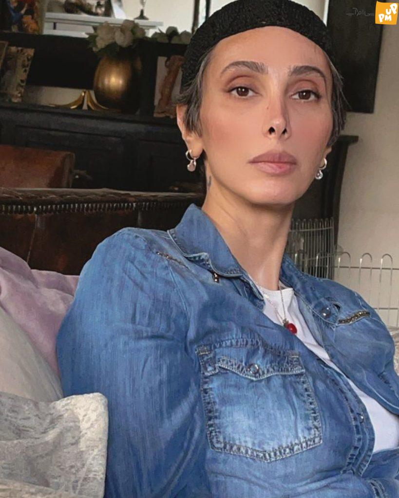 تغییر چهره عجیب خانم بازیگر همه را شوکه کرد!/عکس 1 تغییر چهره عجیب خانم بازیگر همه را شوکه کرد!/عکس