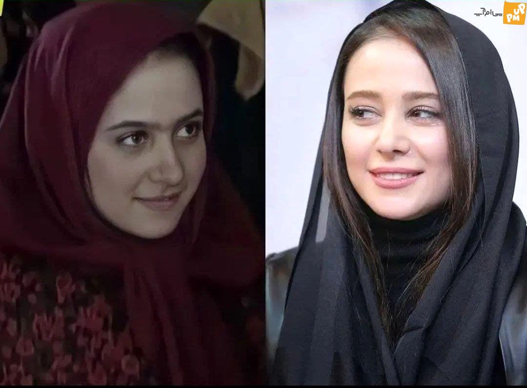 بازیگران ایرانی سردمداران عمل زیبایی در جهان / لو رفتن عکس های قبل عمل بازیگران زن ایرانی! 9 الناز حبیبی قبل عمل زیبایی