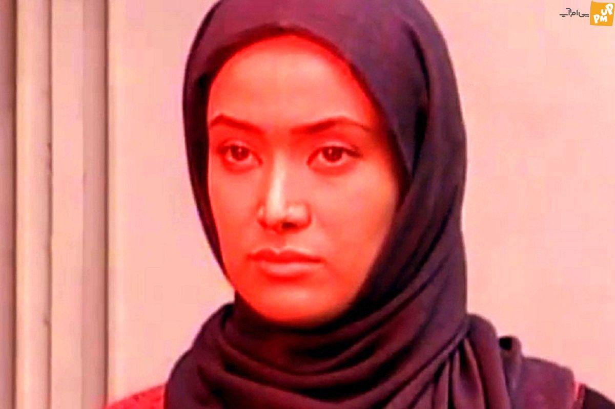 بازیگران ایرانی سردمداران عمل زیبایی در جهان / لو رفتن عکس های قبل عمل بازیگران زن ایرانی! 6 بهاره افشاری قبل عمل زیبایی