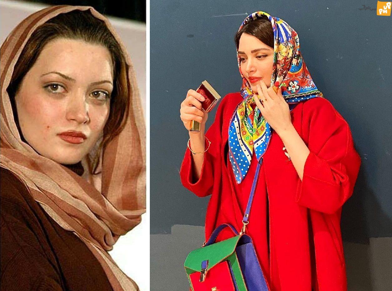 بازیگران ایرانی سردمداران عمل زیبایی در جهان / لو رفتن عکس های قبل عمل بازیگران زن ایرانی! 3 بهنوش طباطبایی قبل عمل