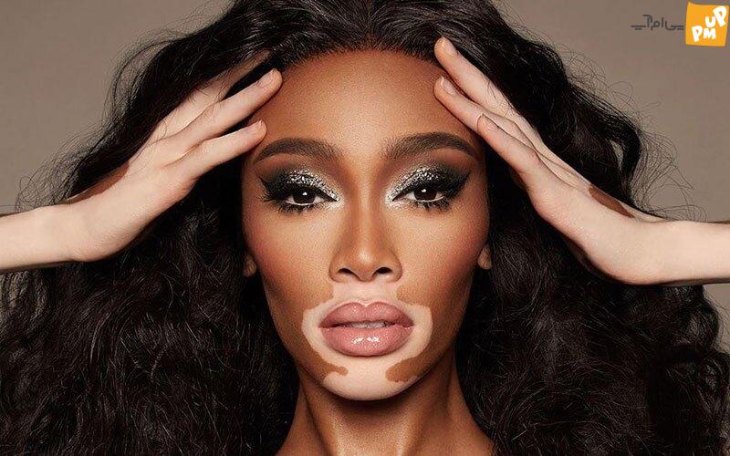 عجیب ترین مدل های دنیا که با دیدن عکس هایشان شگفت زده خواهید شد! عجیب ترین مدل های دنیا که با دیدن عکس هایشان شگفت زده خواهید شد!