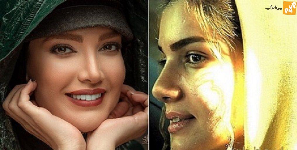 بازیگران ایرانی سردمداران عمل زیبایی در جهان / لو رفتن عکس های قبل عمل بازیگران زن ایرانی! 5 متین ستوده قبل و بعد عمل زیبایی