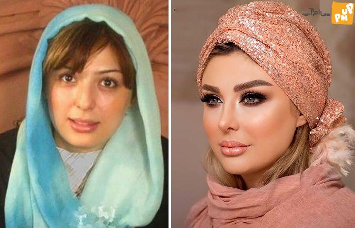 بازیگران ایرانی سردمداران عمل زیبایی در جهان / لو رفتن عکس های قبل عمل بازیگران زن ایرانی! 1 عمل های زیبایی نیوشا ضیغمی