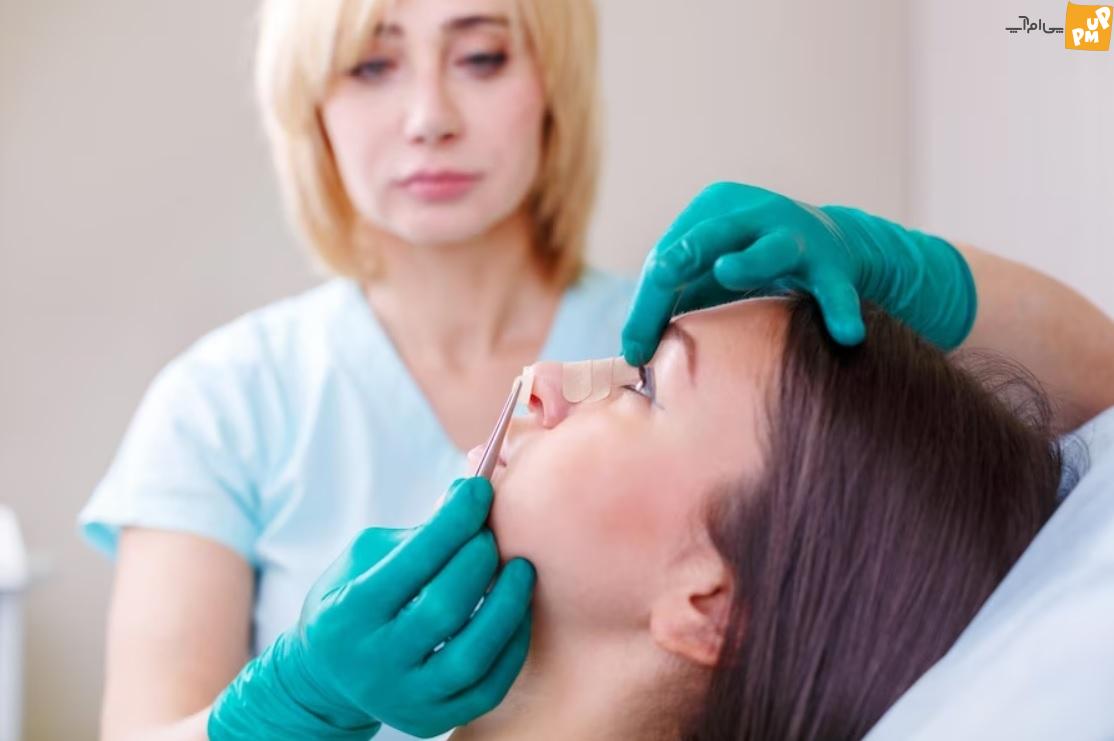 چسب لیفت بینی چیست؟ نحوه استفاده از چسب لیفت بینی چسب لیفت بینی چیست؟ نحوه استفاده از چسب لیفت بینی