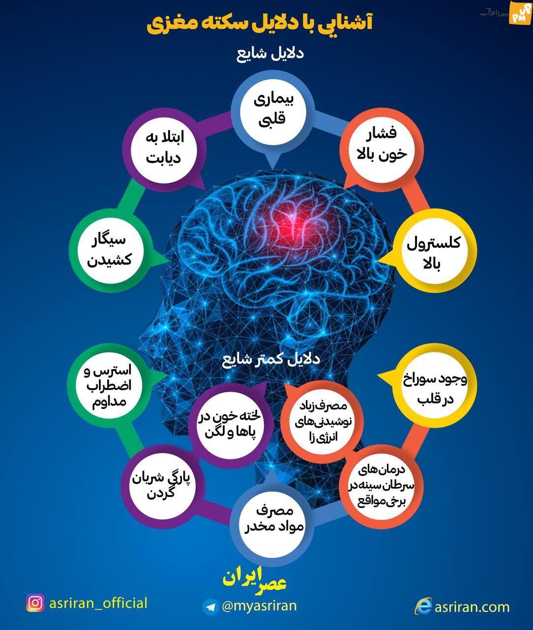 چرا سکته های مغزی زیاد است؟/ این اینفوگرافیک درباره علل سکته مغزی به ما اطلاعات می دهد/عکس