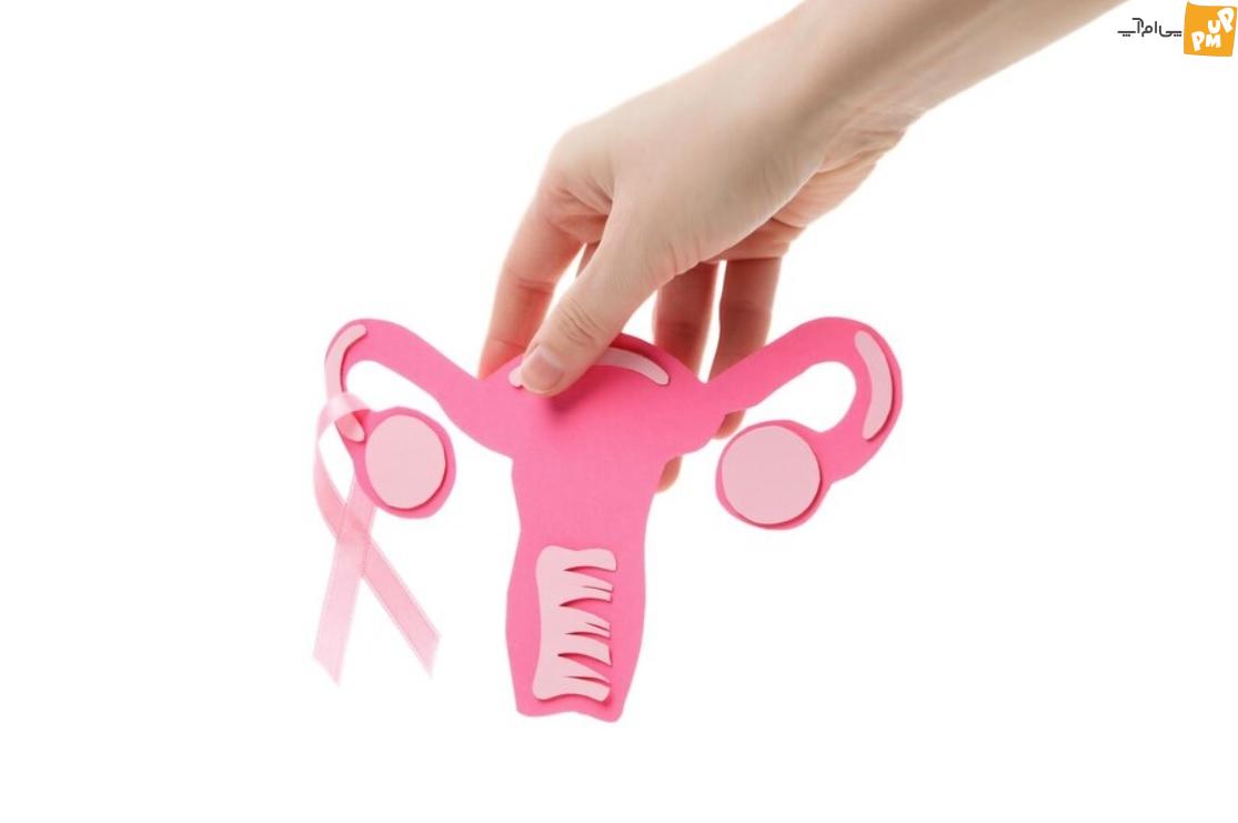 با این درمان خانگی از شر تنبلی تخمدان خلاص شوید با این درمان خانگی از شر تنبلی تخمدان خلاص شوید