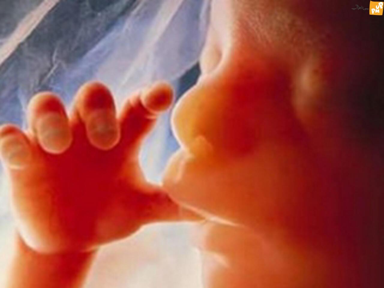 سقط جنین، عوارض و خطرات برای باروری زن سقط جنین، عوارض و خطرات برای باروری زن