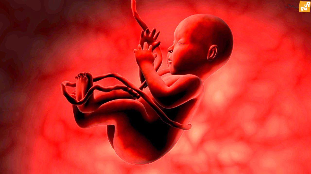 سقط جنین، عوارض و خطرات برای باروری زن سقط جنین، عوارض و خطرات برای باروری زن