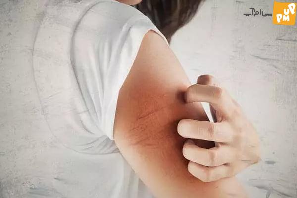 خواص زردآلو چیست ؟ خاصیت های زردآلو که باید بدانید! 8 خاصیت زردآلو در درمان اختلالات پوستی