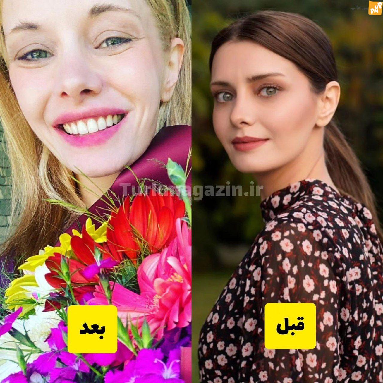 تغییر چهره تولین اجه خبرساز شد!/واکنش گسترده مردم به بازیگر سریال دختر سفیر!/عکس