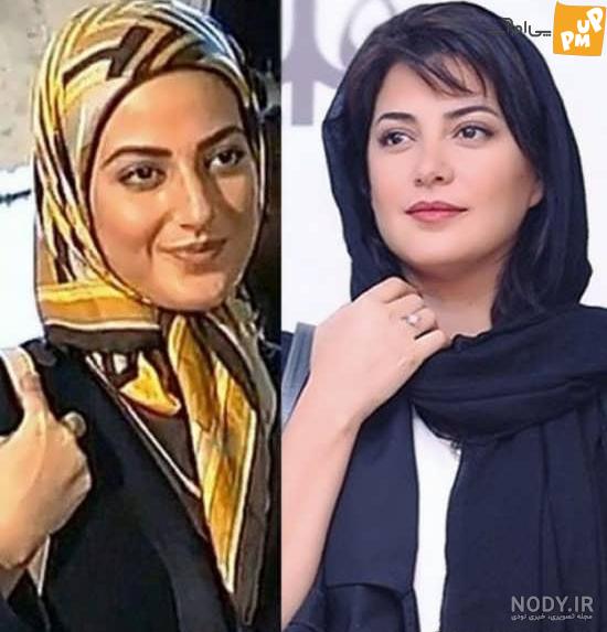 سمی ترین عکس طناز طباطبایی لو رفت! /خانوم بعد عمل بینی چه شکلی شده! 1 سمی ترین عکس طناز طباطبایی لو رفت! /خانوم بعد عمل بینی چه شکلی شده!