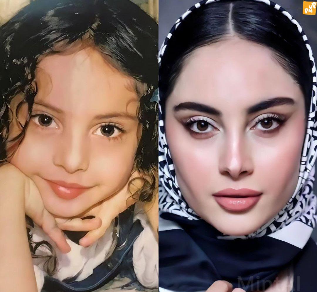 عکس مخفی ترلان پروانه همه چیز را فاش کرد/ عمل زیبایی بازیگر زن! + عکس عکس مخفی ترلان پروانه همه چیز را فاش کرد/ عمل زیبایی بازیگر زن! + عکس