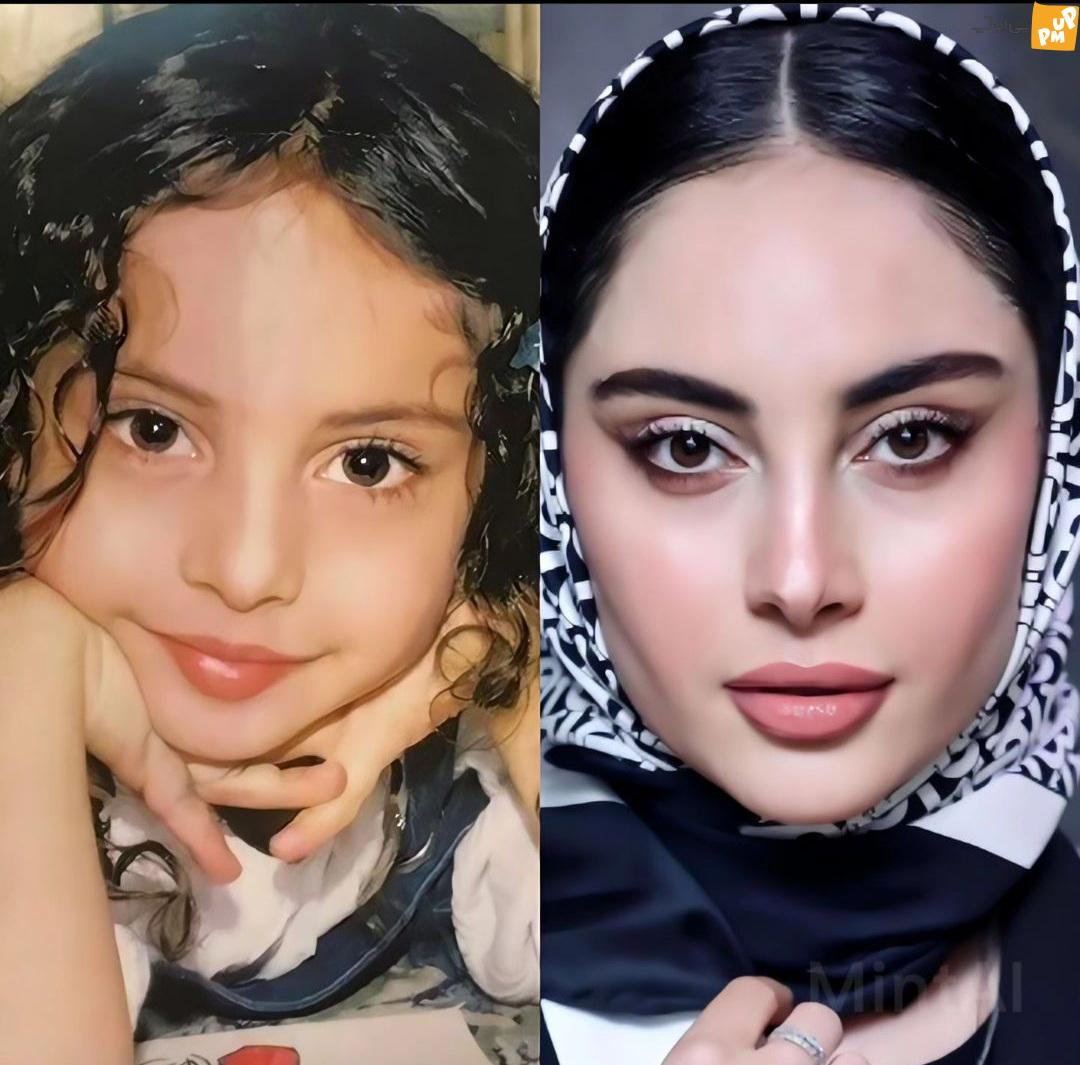 "ترلان پروانه" در کودکی یا الان؟! | مقایسه چهره کودکی ترلان با چهره الان این بازیگر! 1 "ترلان پروانه" در کودکی یا الان؟! | مقایسه چهره کودکی ترلان با چهره الان این بازیگر!