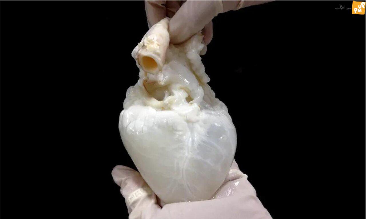 شبح قلب عضوی است که باعث نجات انسانها میشود! /عکس 1 شبح قلب عضوی است که باعث نجات انسانها میشود! /عکس