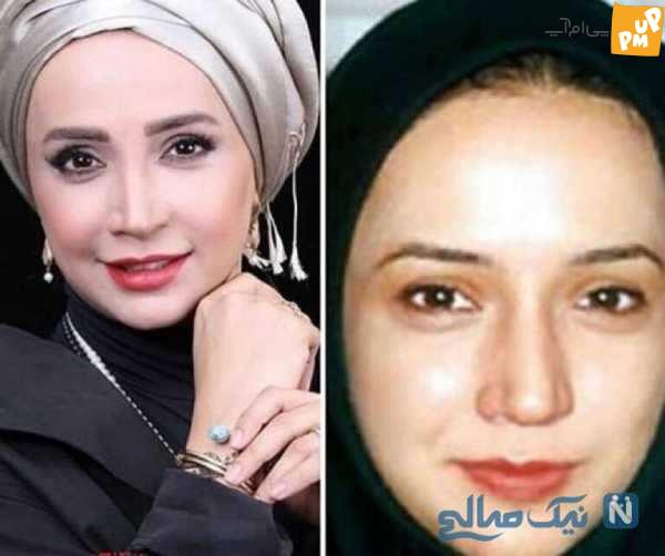 لو رفتن عکس قبل از عمل شبنم قلی خانی جنجالی شد!/عکس 1 لو رفتن عکس قبل از عمل شبنم قلی خانی جنجالی شد!/عکس