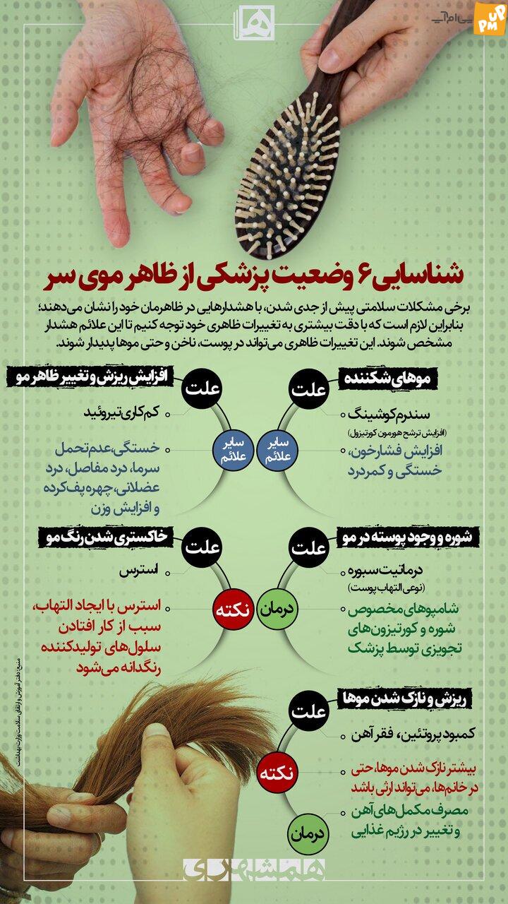 6 نشانه ظاهری مو که دلیلی بر بیماریست! / این نشانه ها را جدی بگیرید! + عکس 1 6 نشانه ظاهری مو که دلیلی بر بیماریست! / این نشانه ها را جدی بگیرید! + عکس
