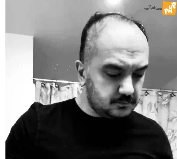 چهره عجیب و شکسته سرور معروف پس از مهاجرت + عکس چهره عجیب و شکسته سرور معروف پس از مهاجرت + عکس
