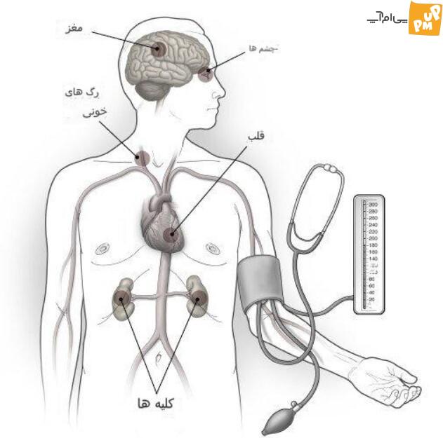 فشار خون؛ علائم و روش های درمان فشار خون؛ علائم و روش های درمان